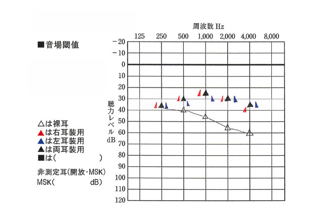 装用閾値測定