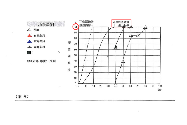 音場語音明瞭度測定