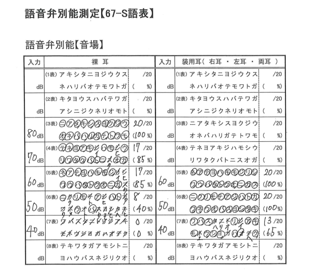 語音弁別能測定
