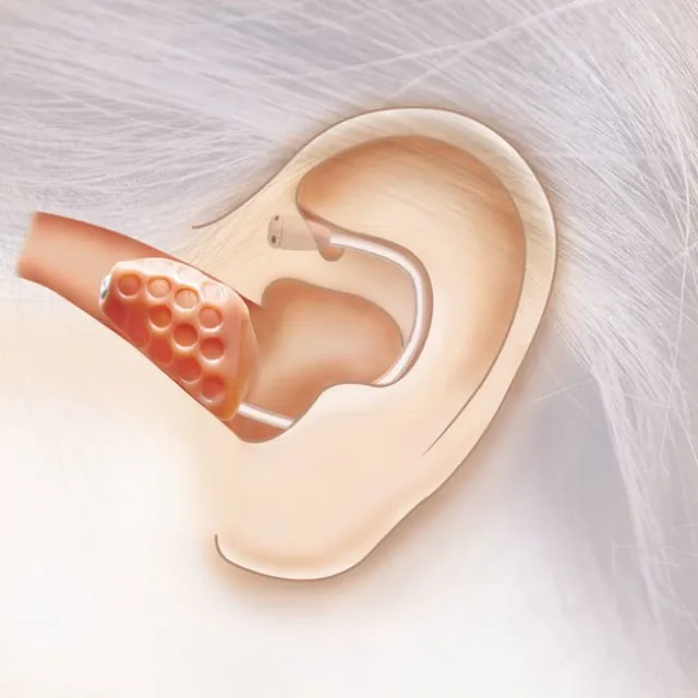 補聴器によって外耳道（耳の穴）が塞がれるためです。